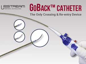 GoBack™ Catheter